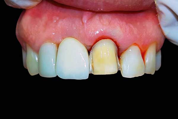 Dental Diseases and Problems