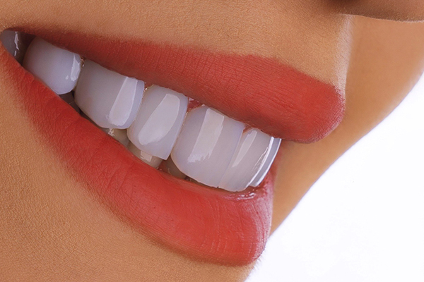 💬 Lumineers Turkey Reddit: 13 Honest Things People Really Say Before Choosing a Smile in 2026